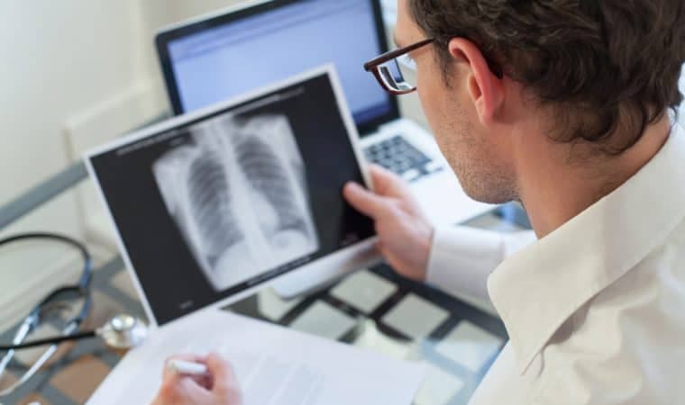 Ministérios da Saúde e Cidadania se unem no combate à tuberculose