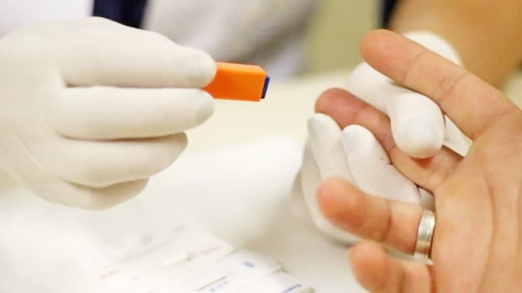 Anvisa aprova realização de testes rápidos de coronavírus em farmácias