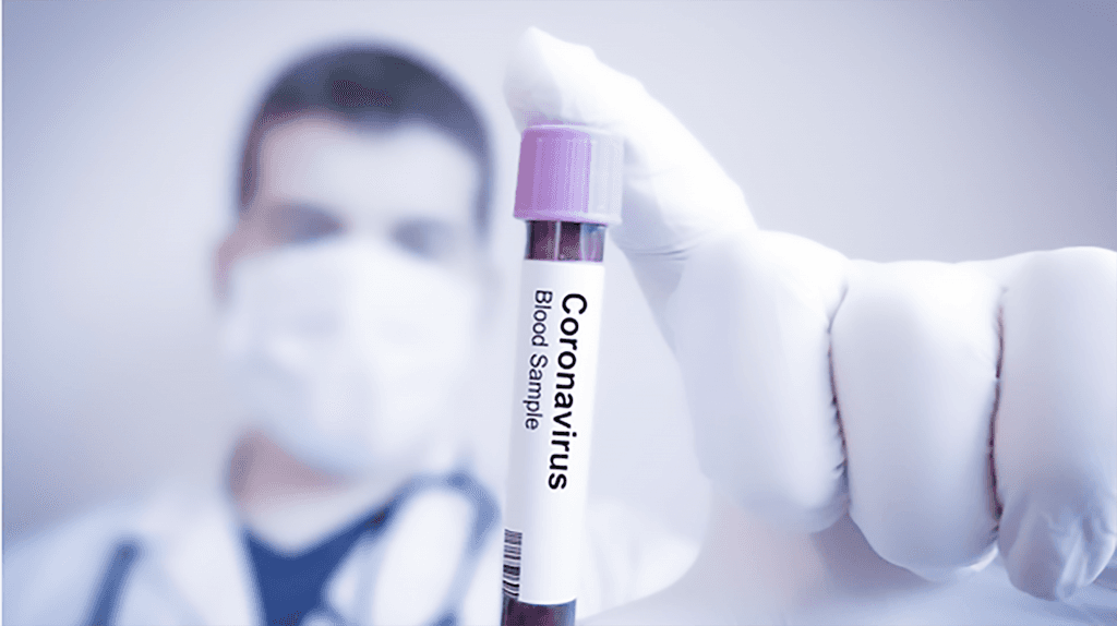 Estudo sugere que curados de Covid não transmitem mais a doença