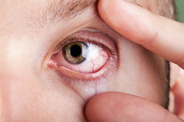 Cuidados com os olhos em período de tempo seco