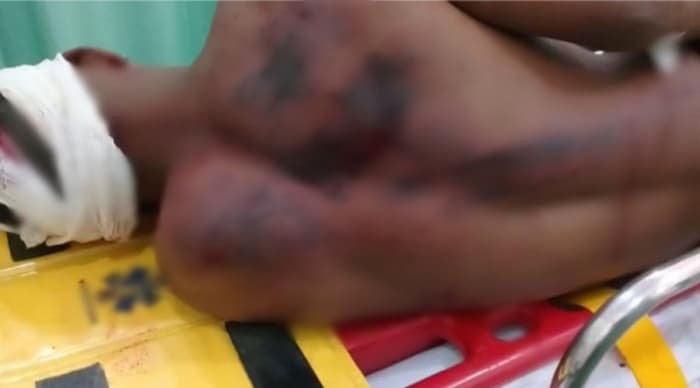 Padrasto preso por espancar enteado de 17 anos com pedaço de madeira já tentou matar mãe da vítima a facadas