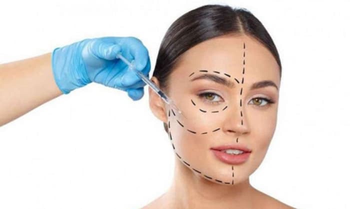 Reversão de harmonização facial: dermatologista explica processo e alerta sobre banalização do procedimento