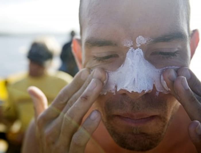 Incidência de câncer de pele é maior em homens