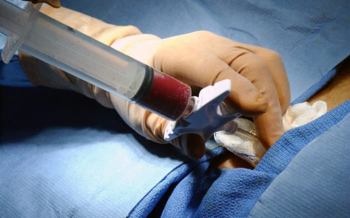 Portadores do câncer precisam ser transplantados mesmo em meio a pandemia